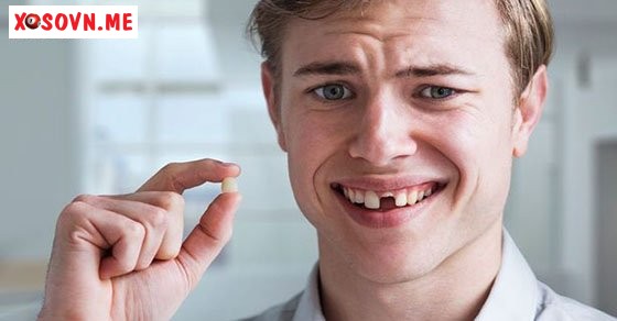 Mơ thấy gãy răng – Chiêm bao thấy gãy răng đánh con gì?